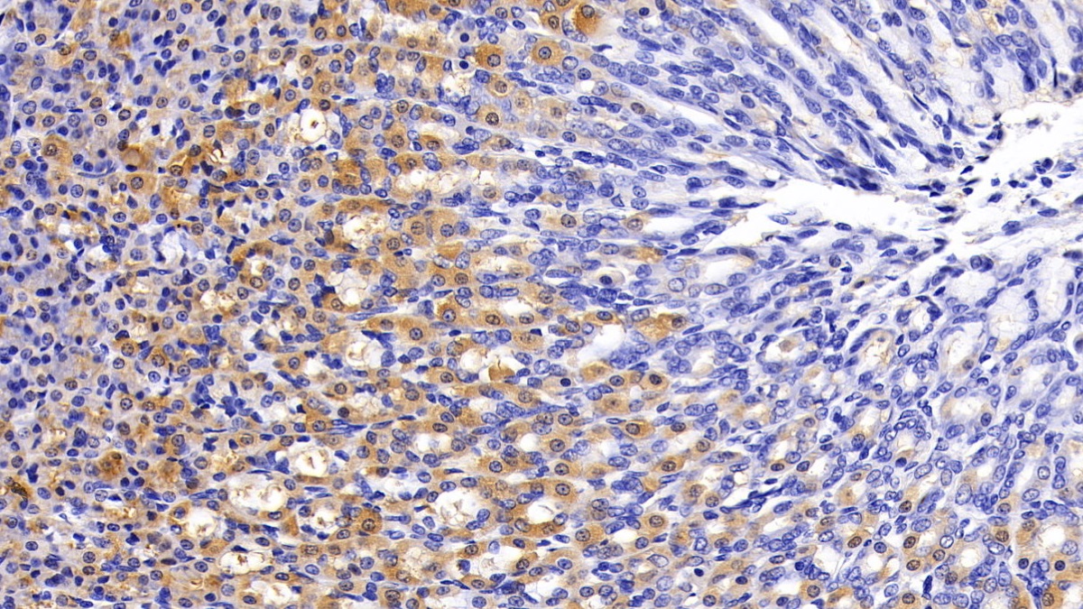 Gastrin (GT) Rat Polyclonal Antibody