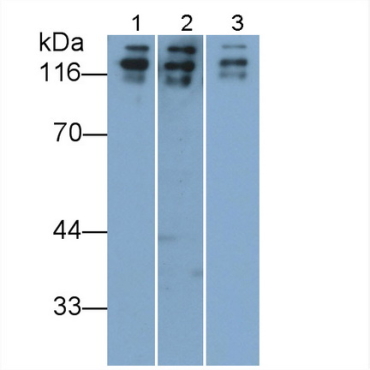 Cluster Of Differentiation 56 (CD56) Human Polyclonal Antibody