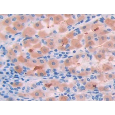 Corticosteroid Binding Globulin (CBG) Human Polyclonal Antibody