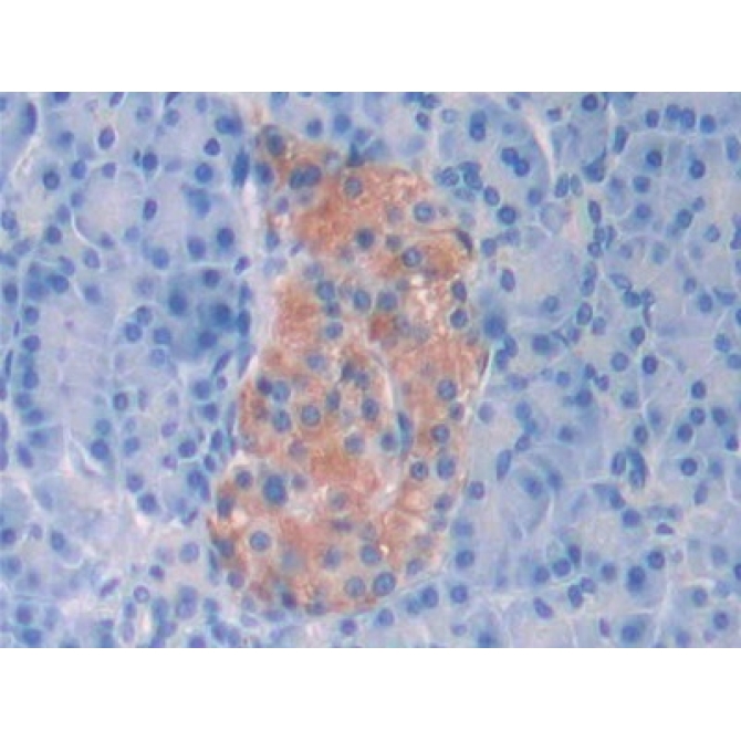 Corticosteroid Binding Globulin (CBG) Human Polyclonal Antibody
