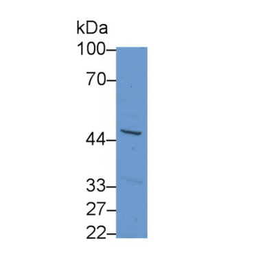 Corticosteroid Binding Globulin (CBG) Human Polyclonal Antibody