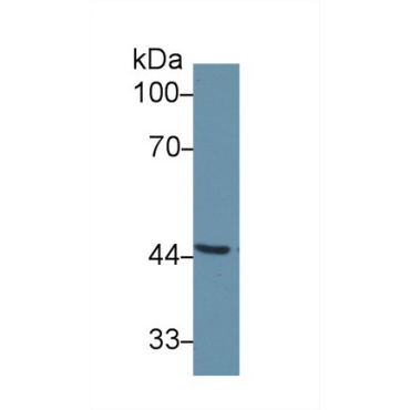 Corticosteroid Binding Globulin (CBG) Human Polyclonal Antibody