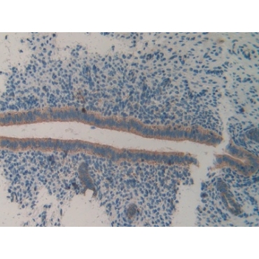 Integrin Alpha 2 (ITGa2) Mouse Polyclonal Antibody