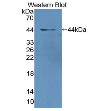 MAX Gene Associated Protein (MgA) Human Polyclonal Antibody