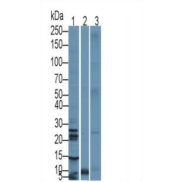 Cytotoxic T-Lymphocyte Associated Antigen 4 (CTLA4) Human Polyclonal Antibody