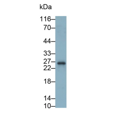 Cytotoxic T-Lymphocyte Associated Antigen 4 (CTLA4) Human Polyclonal Antibody
