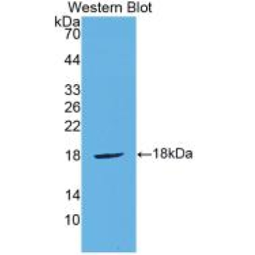 Cytotoxic T-Lymphocyte Associated Antigen 4 (CTLA4) Mouse Polyclonal Antibody