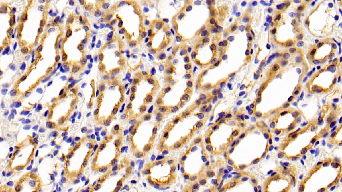 Cytotoxic T-Lymphocyte Associated Antigen 4 (CTLA4) Rat Polyclonal Antibody