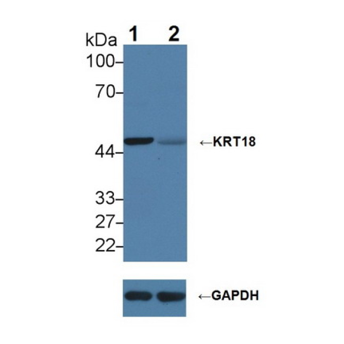 Cytokeratin 18 (CK18) Human Polyclonal Antibody