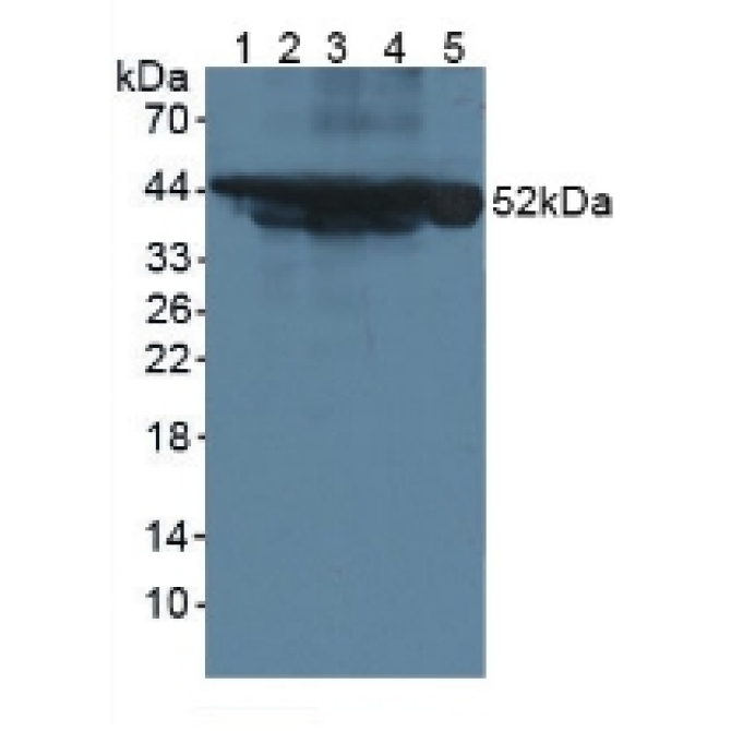 Cytokeratin 18 (CK18) Mouse Polyclonal Antibody