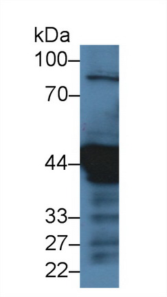 Cytokeratin 18 (CK18) Pig Polyclonal Antibody