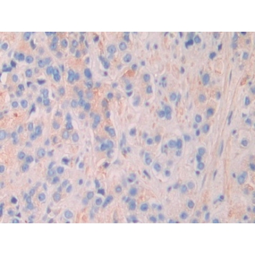 Matrix Extracellular Phosphoglycoprotein (MEPE) Human Polyclonal Antibody