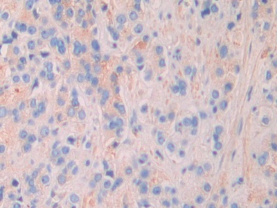 Matrix Extracellular Phosphoglycoprotein (MEPE) Human Polyclonal Antibody