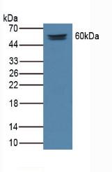 Matrix Extracellular Phosphoglycoprotein (MEPE) Rat Polyclonal Antibody