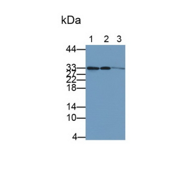 Cyclin Dependent Kinase 4 (CDK4) Human Polyclonal Antibody
