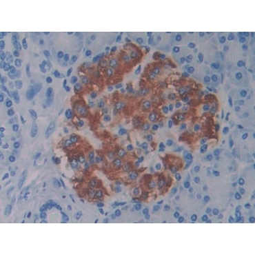Bactericidal/Permeability Increasing Protein (BPI) Human Polyclonal Antibody