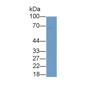 Cholinergic Receptor, Muscarinic 5 (CHRM5) Human Polyclonal Antibody