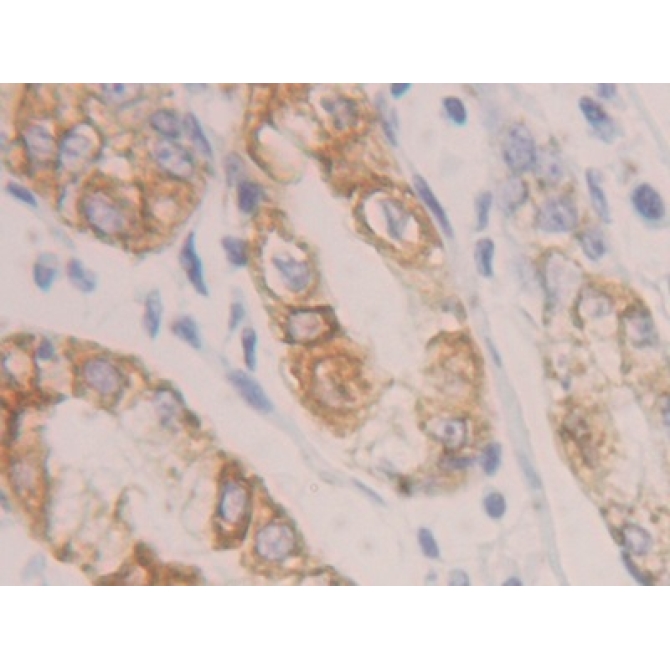 Cytokeratin 19 (CK19) Human Polyclonal Antibody