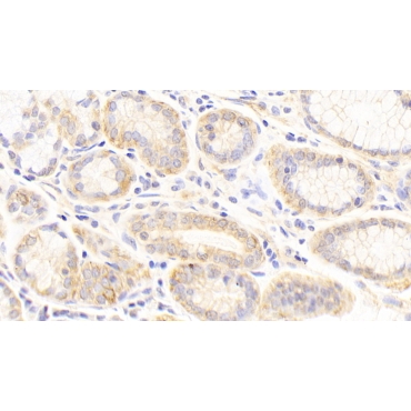 Cytokeratin 19 (CK19) Human Polyclonal Antibody