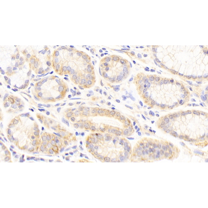 Cytokeratin 19 (CK19) Human Polyclonal Antibody