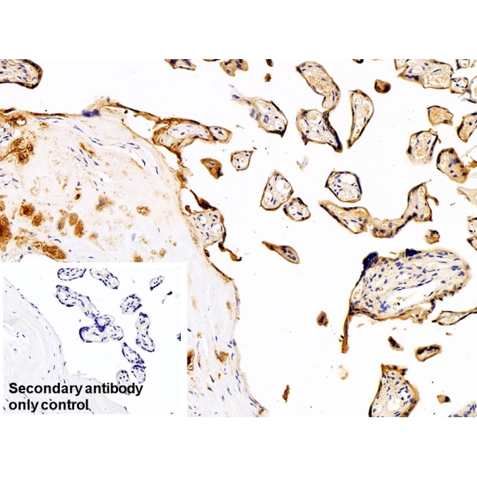 Cytokeratin 19 (CK19) Human Polyclonal Antibody