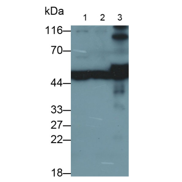 Cytokeratin 19 (CK19) Human Polyclonal Antibody
