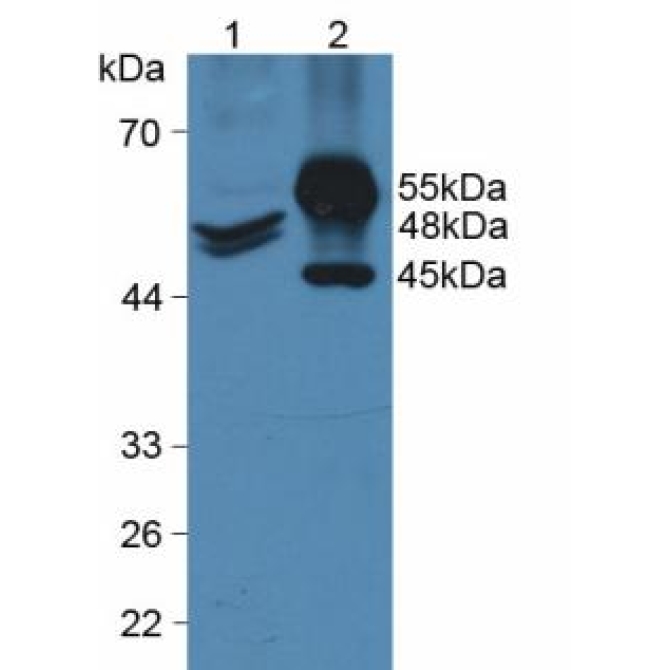 Cytokeratin 20 (CK 20) Human Polyclonal Antibody