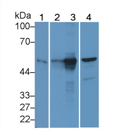 Cytokeratin 20 (CK 20) Mouse Polyclonal Antibody