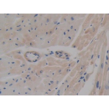 ATP Binding Cassette Transporter A1 (ABCA1) Mouse Polyclonal Antibody
