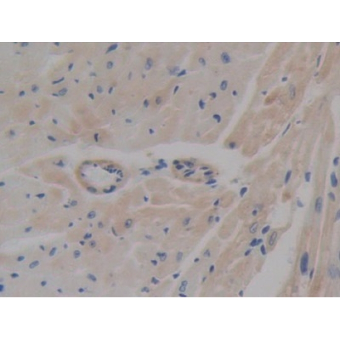 ATP Binding Cassette Transporter A1 (ABCA1) Mouse Polyclonal Antibody