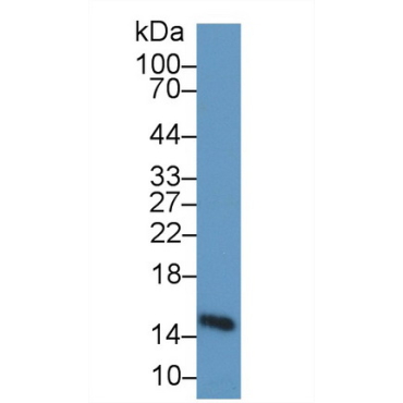 Heart-type Fatty Acid Binding Protein (H-FABP) Human Polyclonal Antibody