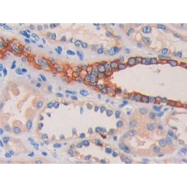 Cytokeratin Fragment Antigen 21-1 (CYFRA21-1) Human Polyclonal Antibody