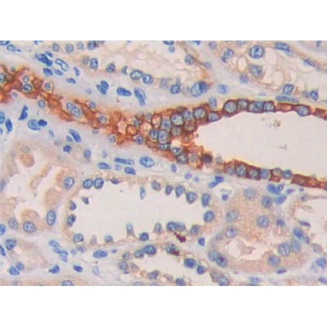 Cytokeratin Fragment Antigen 21-1 (CYFRA21-1) Human Polyclonal Antibody