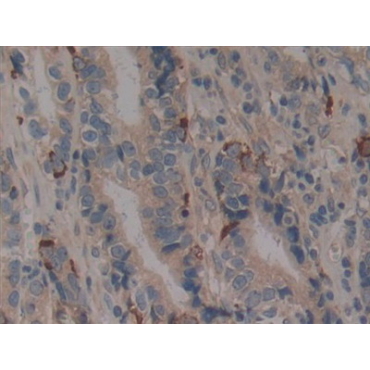 Tumor Necrosis Factor Receptor Superfamily, Member 5 (CD40) Human Polyclonal Antibody