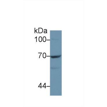 Cluster Of Differentiation 73 (CD73) Human Polyclonal Antibody
