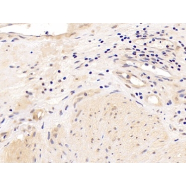 Androgen Receptor (AR) Human Polyclonal Antibody