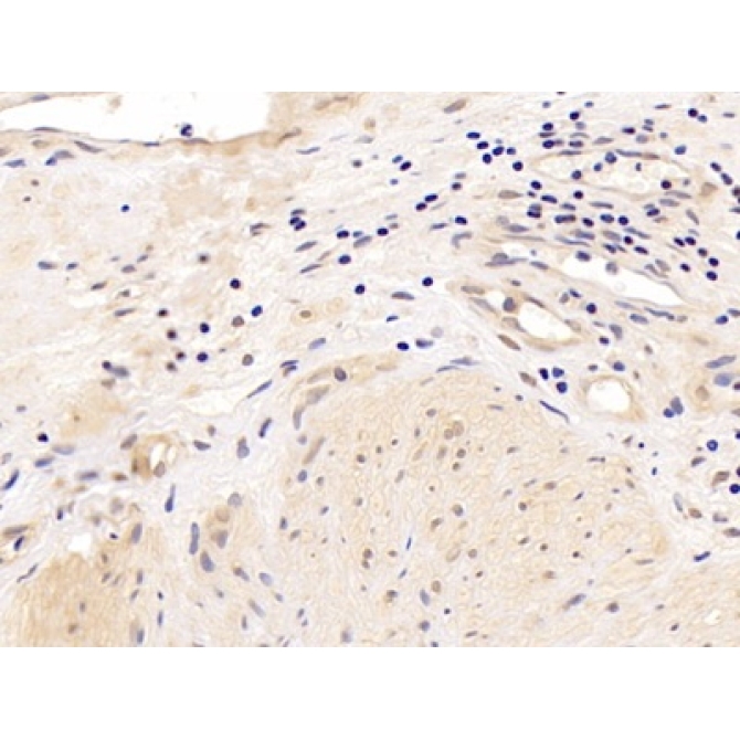 Androgen Receptor (AR) Human Polyclonal Antibody
