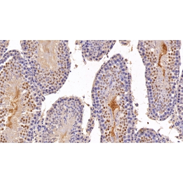 Androgen Receptor (AR) Human Polyclonal Antibody
