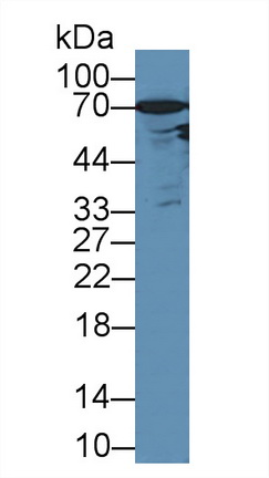Androgen Receptor (AR) Rat Polyclonal Antibody