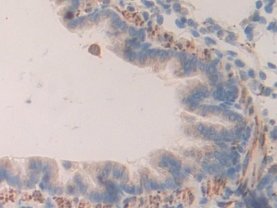 Prolylcarboxypeptidase (PRCP) Rat Polyclonal Antibody