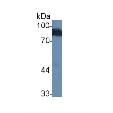 Angiostatin (ANG) Human Polyclonal Antibody