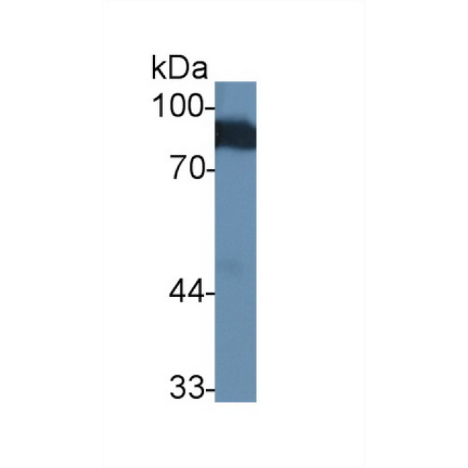 Angiostatin (ANG) Human Polyclonal Antibody