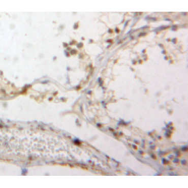 Down Regulator Of Transcription 1, TBP Binding (DR1) Human Polyclonal Antibody