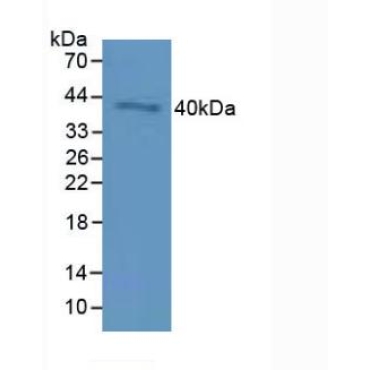 Cluster Of Differentiation 72 (CD72) Human Polyclonal Antibody