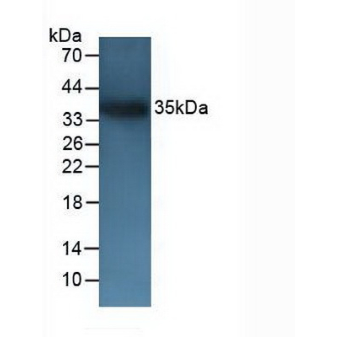 Cluster Of Differentiation 72 (CD72) Mouse Polyclonal Antibody