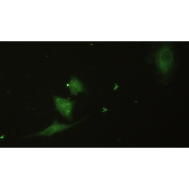Integrin Beta 3 (ITGb3) Human Polyclonal Antibody
