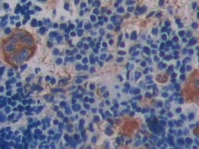 Integrin Beta 3 (ITGb3) Mouse Polyclonal Antibody
