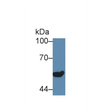 Arginine Vasopressin Receptor 1B (AVPR1B) Human Polyclonal Antibody