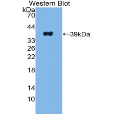 Pancreatic Polypeptide (PP) Human Polyclonal Antibody