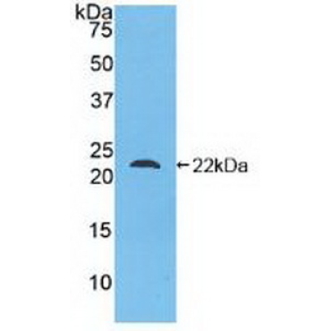 Glucagon (GCG) Human Polyclonal Antibody
